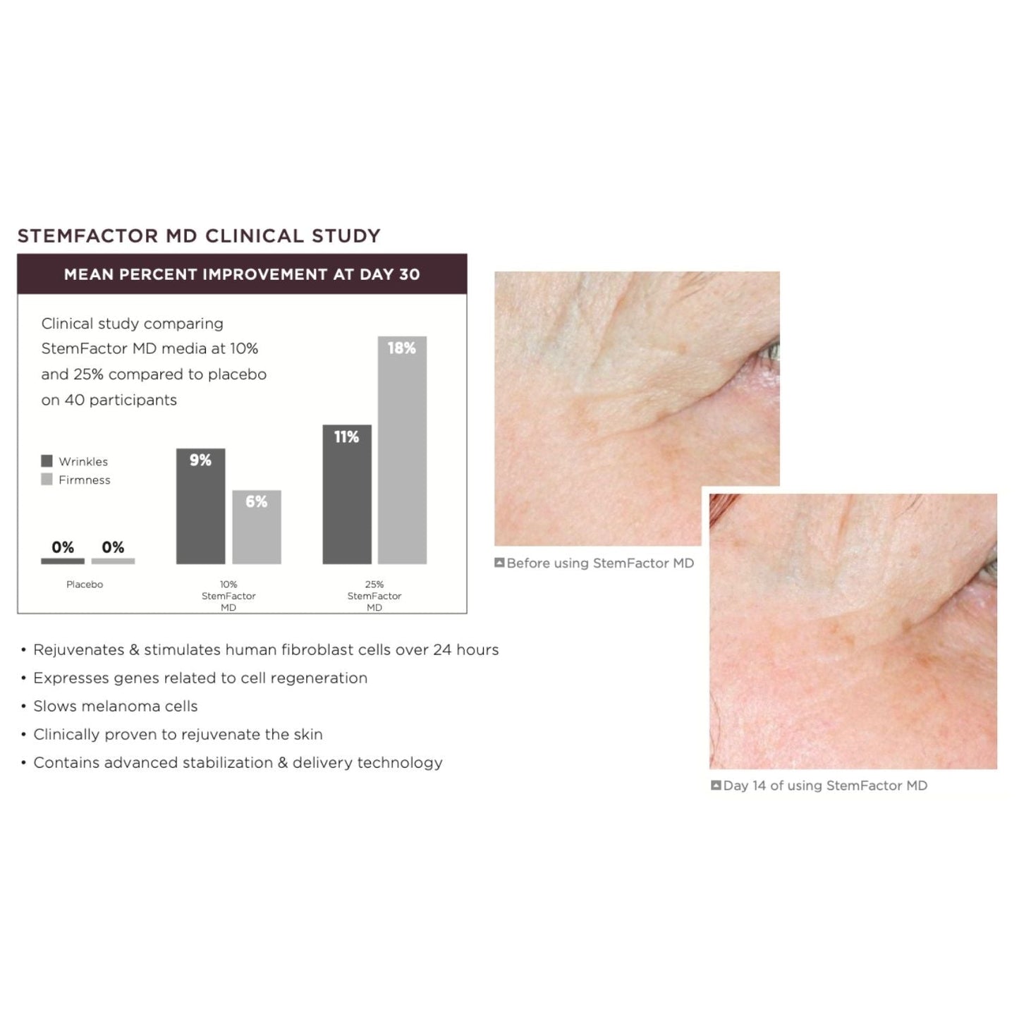 infograph with text and before and after results from stemfactor by osmosis